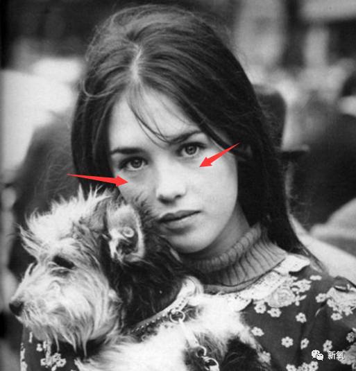 整形|鼻翼|阿佳妮_新浪女性_新浪网