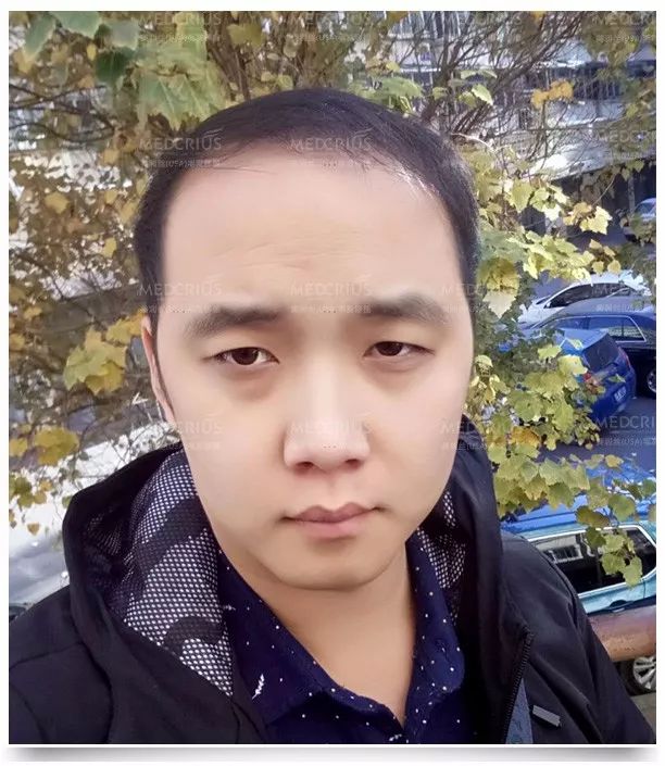 网友:脱发还能这么治?