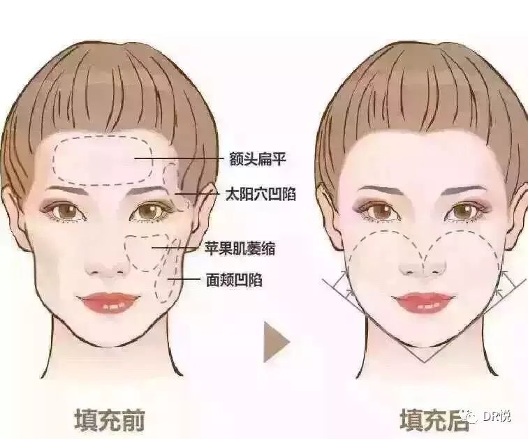 外国人对心形脸有点误解吧…|心形|面部|外国人_新浪女性_新浪网