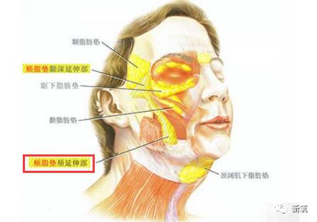 被称为最丑紫薇的她都把自己填成气球了