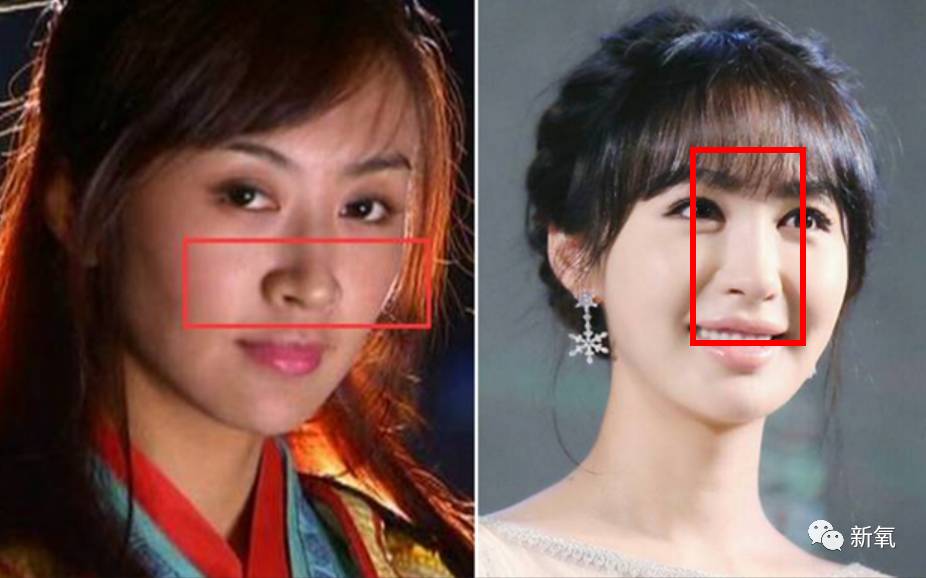 继脸僵成杨紫之后李菲儿的嘴是被毒蛇咬了么