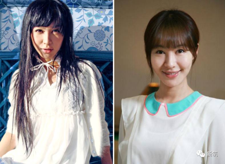 继脸僵成杨紫之后,李菲儿的嘴是被毒蛇咬了么