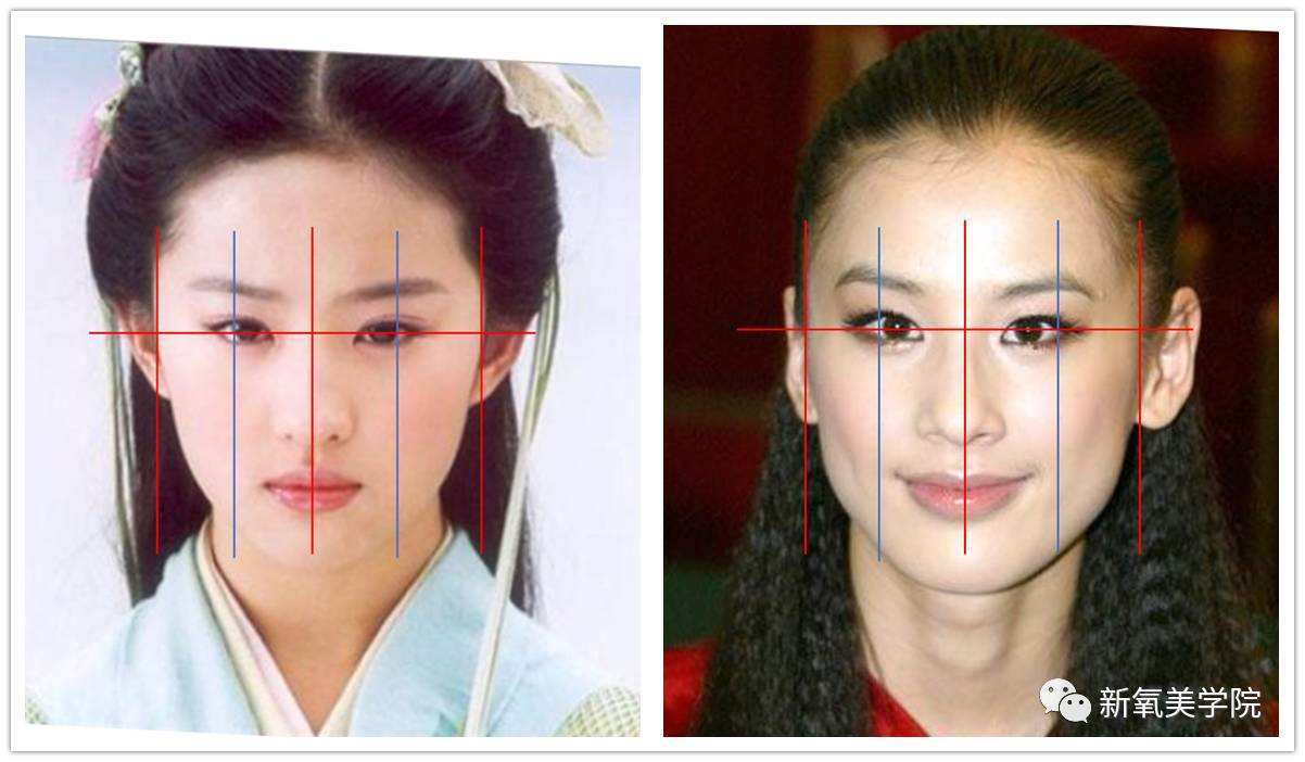 刘亦菲到底是不是斗鸡眼?