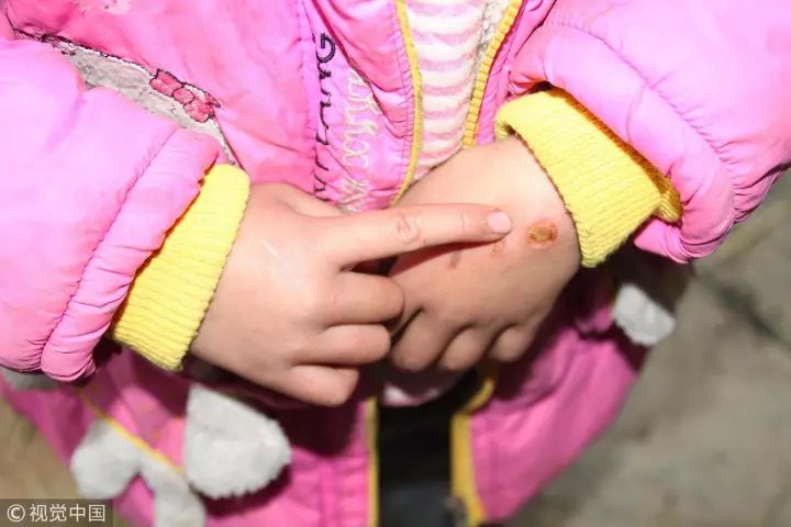 为什么幼儿园虐童事件频发?