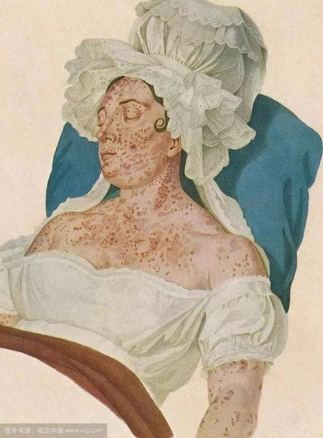 家长注意!香港发出警报:这种传染病近期病例显著增加!