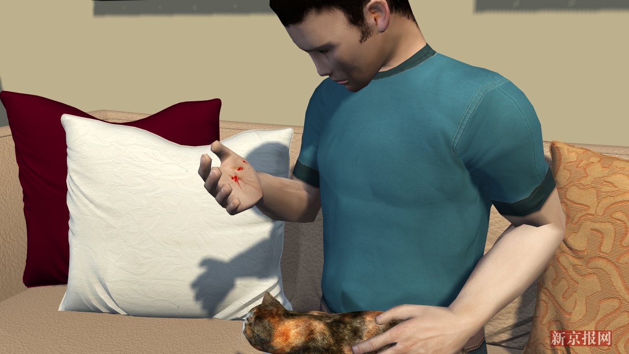 3d:《急诊科医生》现实版!40岁壮男长核桃大肿块竟因爱猫