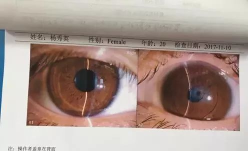 20岁贵州姑娘熬夜玩手机突然瞎了你还敢熬夜玩手机吗