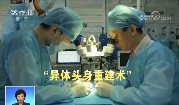 中国教授完成全球首例人类“换头术”耗时18小时