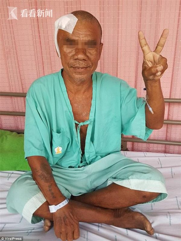 视频|贫苦老汉脑袋长巨瘤形似"双头怪" 被路人一照捧红重获新生