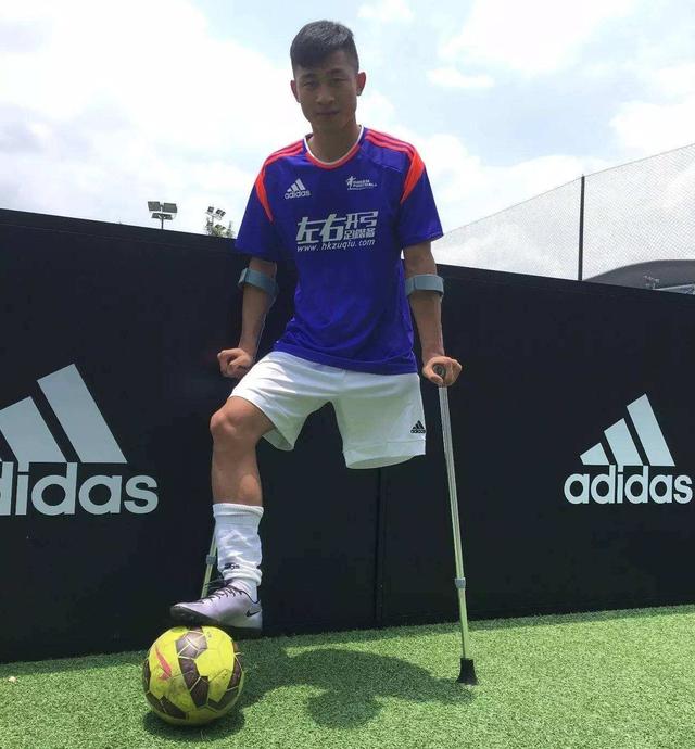 国独腿球王用一条腿征服世界,球迷:国足有他