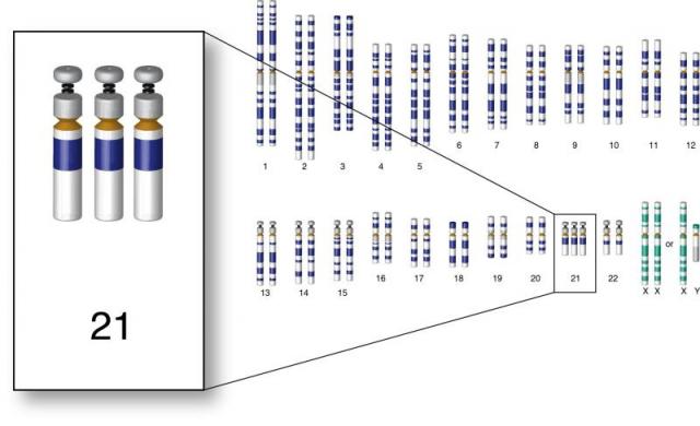 视频我国科学家实现完整敲除染色体有望治疗唐氏综合征