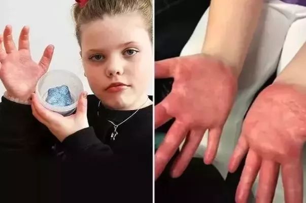 家长千万别让孩子玩儿|中毒|水晶泥|硼砂_新浪新闻