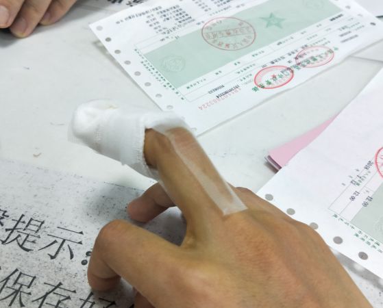 指头炎医生确诊小刘的手指小刘赶紧来到医院急诊科就诊直到她彻夜难眠