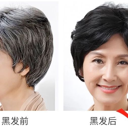 白发变黑发产品排行榜 白发转黑发品牌排行榜