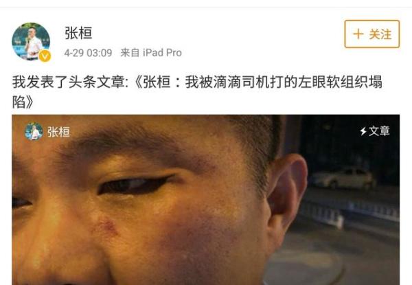 4月28日晚间,疯蜜创始人,滴滴投资人张桓发文称被滴滴司机殴打.