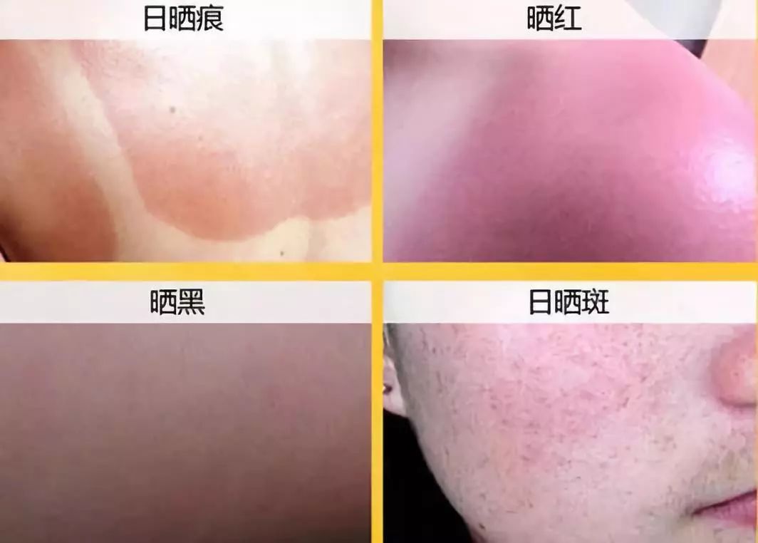 晒黑敏感假白泰国防晒界黑马出击28天白成一道光修复敏感肌