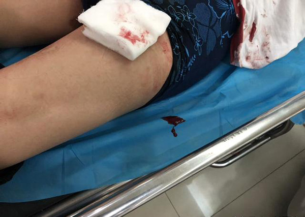 陕西渭南一城管被商贩捅伤腿部,疑占道经营引纠纷,警方介入