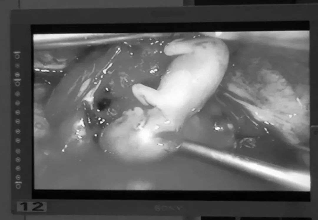 怀孕一个月胎儿有多大图片