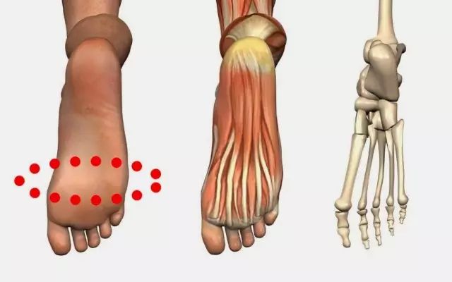 防损伤专栏|前脚掌疼痛,有可能是"跖骨"搞的鬼