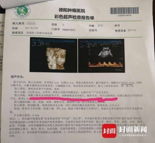 罗云到医院做了"彩超胎儿四维彩超常规"项目的检查,报告单上超声所见