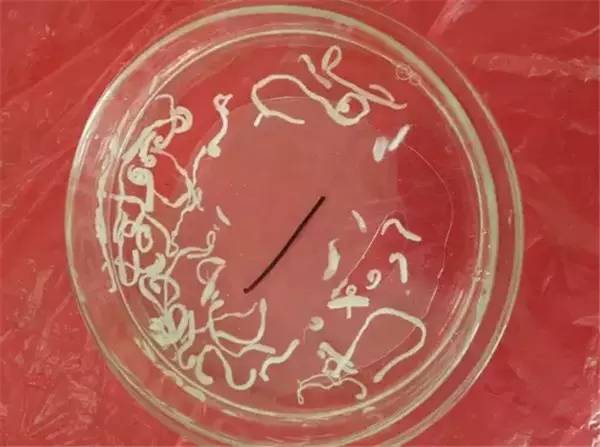 专家介绍说,曼氏裂头蚴是曼氏迭宫绦虫的幼虫,它主要寄生于青蛙,蛇的