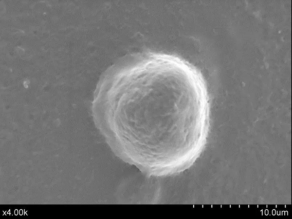 电镜下的人体肝癌细胞（图片来源中科院微生物所）