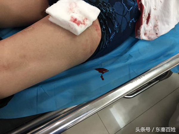 陕西渭南一城管被商贩捅伤腿部疑占道经营引纠纷警方介入