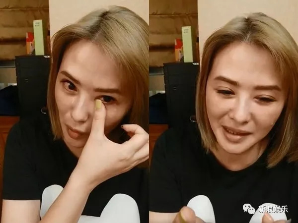 其实女明星打针都是常态了吧