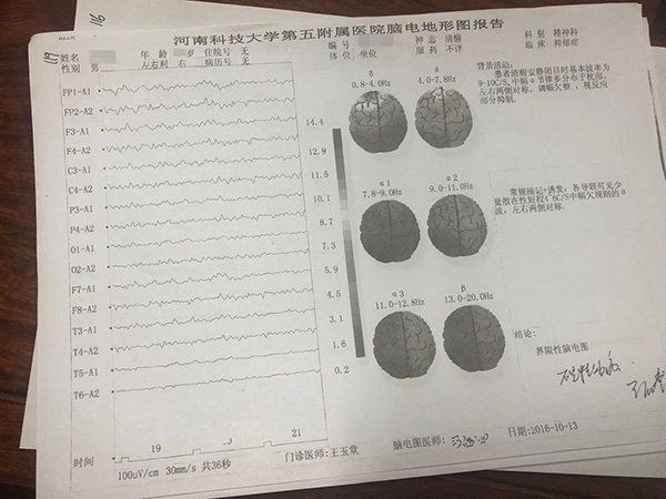 赵阳出院后到其他医院做的脑电地形图报告显示:"不是精神病".