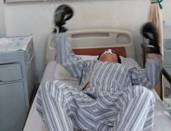 男生每天打眼睛致视网膜脱落直到头颅装脑起搏器 手机新浪网