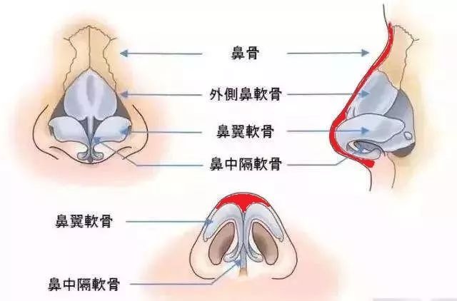 按理说她那么有钱,鼻子不应该透光啊…|假体|硅胶|隆鼻_新浪女性_新浪