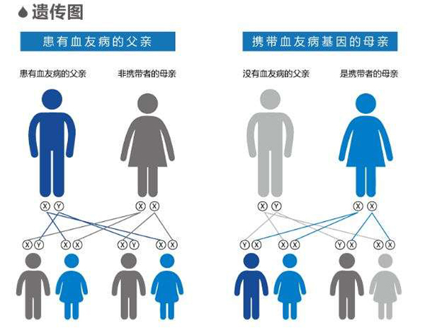 问答曾被称作欧洲皇室病的血友病为何发病的全是男性
