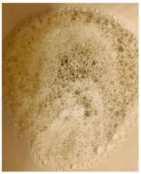 尿中为什么有泡沫,终于有了权威解释!|疾病|化验_新浪新闻