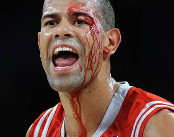 红色火箭,怀念青春之"总统"巴蒂尔!