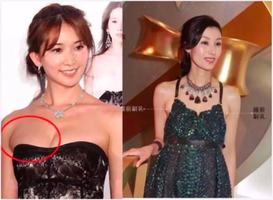 因为它支撑力好,美化胸型,能防止胸部下垂和外扩