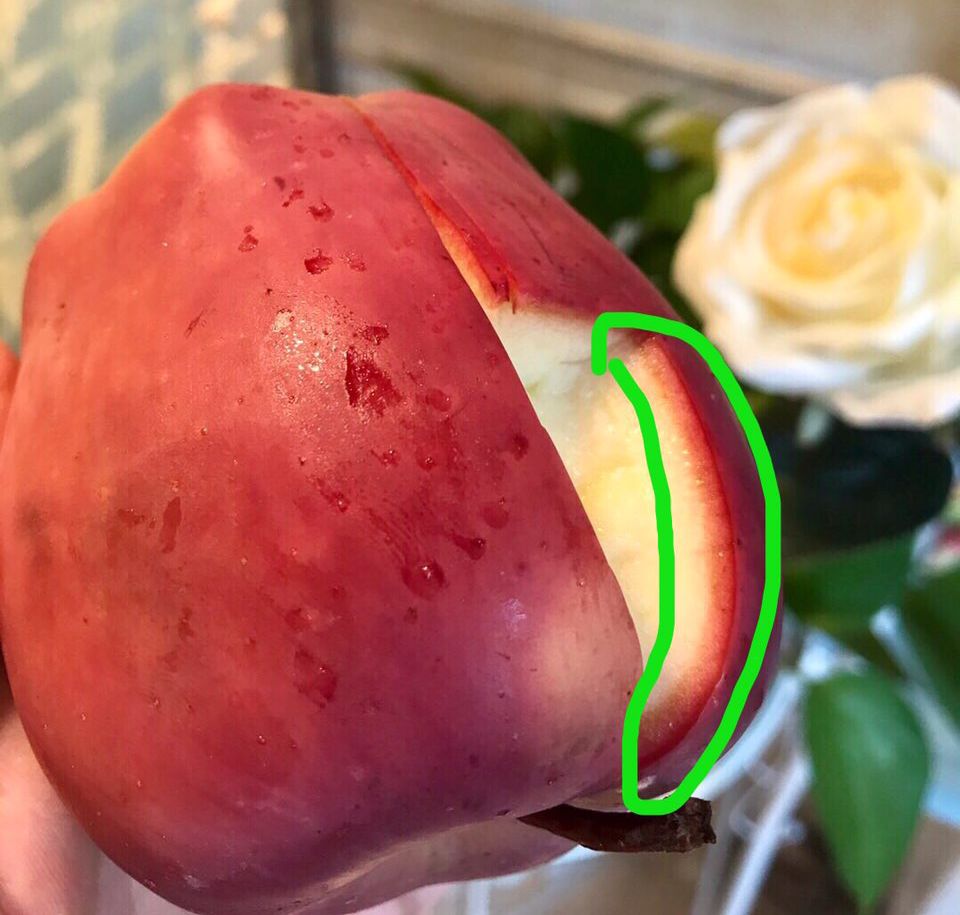 看见这个苹果想起了以前我脸上有斑的时候就是这样一点一点的，幸亏现在把斑治好了，不然就扎心了