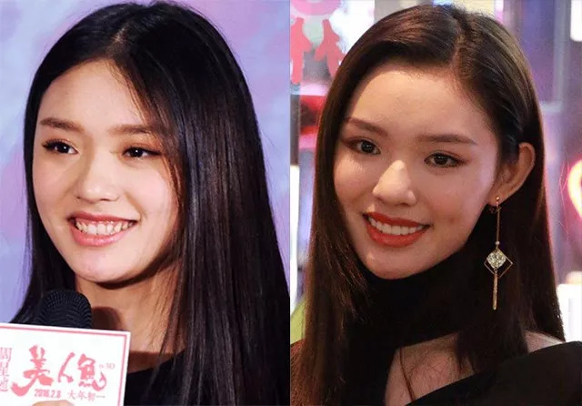 牙贴|牙齿|林允_新浪新闻