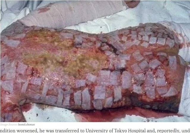 日本茨城核设施发生放射性物质外泄 事发现场有9名员工
