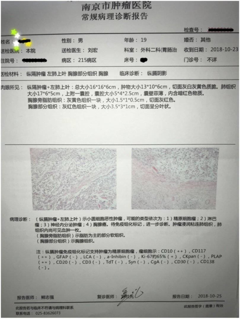 最大径13cm南京市第二医院切除一罕见恶性肿瘤医生提示