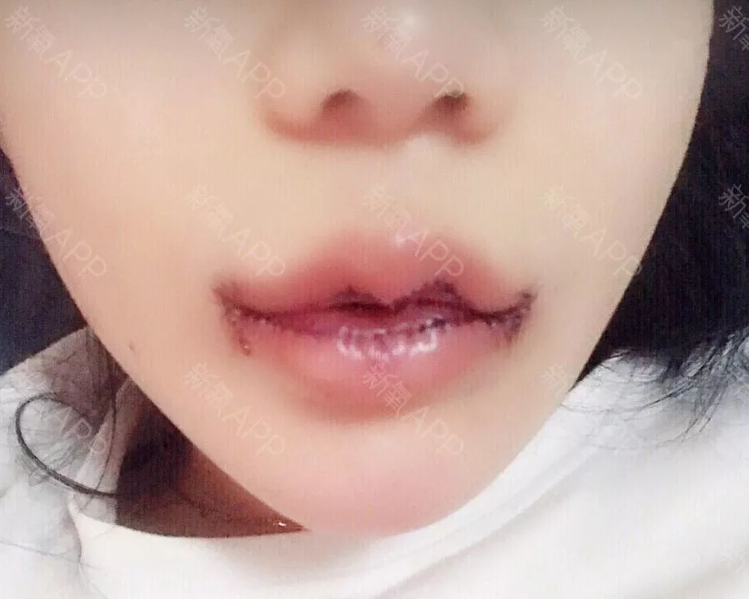 娱乐圈又一瘪嘴女神诞生还是个00后小小花