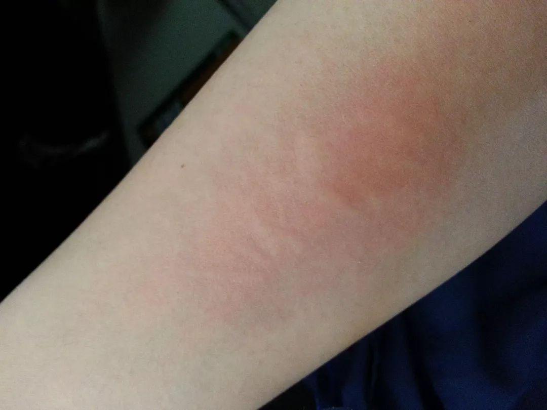 琳琅满目的防晒霜你真的选对了吗