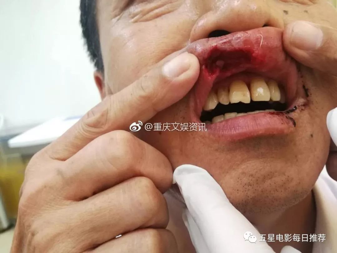 重庆轻轨上演"釜山行" 女子发狂咬人脱衣舔血宛如丧尸