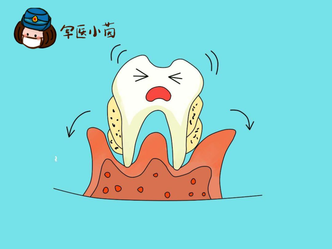 军医小茵 | 洁牙科普!你有多久没给牙齿洗澡了?
