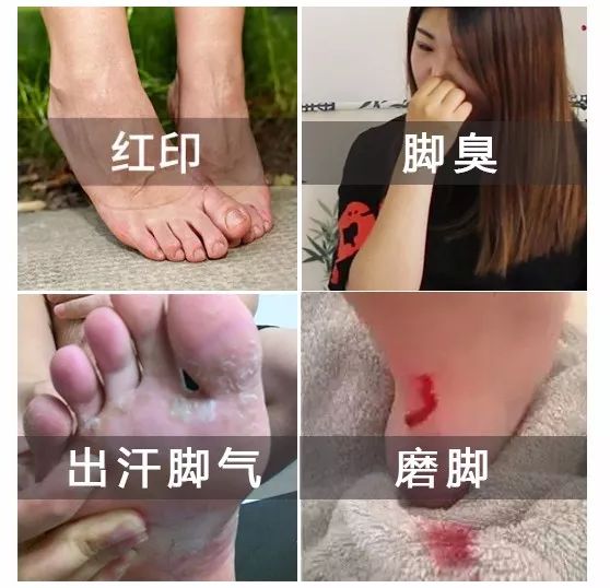 医生说脚气,鸡眼也是这么招来的!