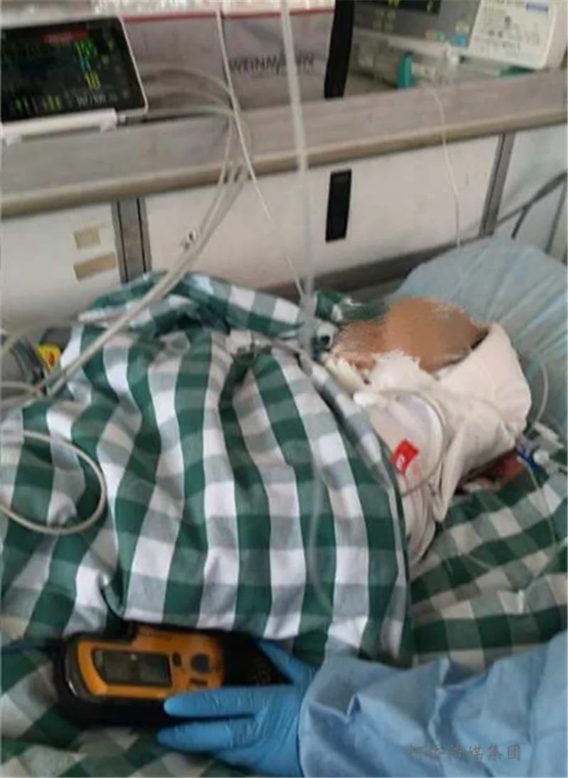 正文记者从宝宝家人处了解到,虽经紧急手术,但孩子脑部已死亡,目前靠