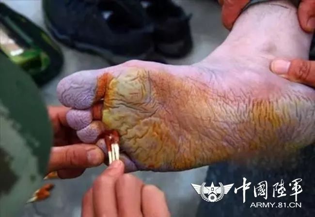 的脚是一双粗糙得让人心疼落泪的脚一双兵哥的手vs一双纤纤玉手亲们