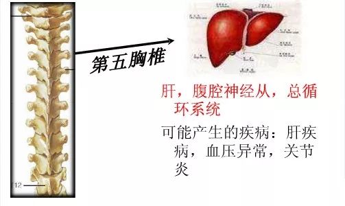 胸椎痛背部疼痛是怎么回事 胸骨和骶骨疼是什么原因