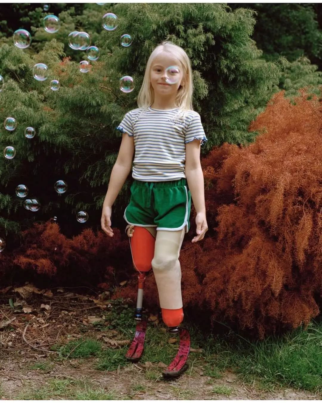 7岁无腿女孩一夜刷屏朋友圈,生来残缺,备受欺凌,她却做了一个这样的