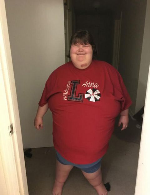 hankins,在2岁的时候被症断出患有普拉德 - 威利综合征(pws),从那以后