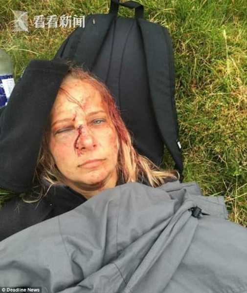 女子登山从15米高岩石摔落满脸是血 微笑拍照浑然不知脖子断了